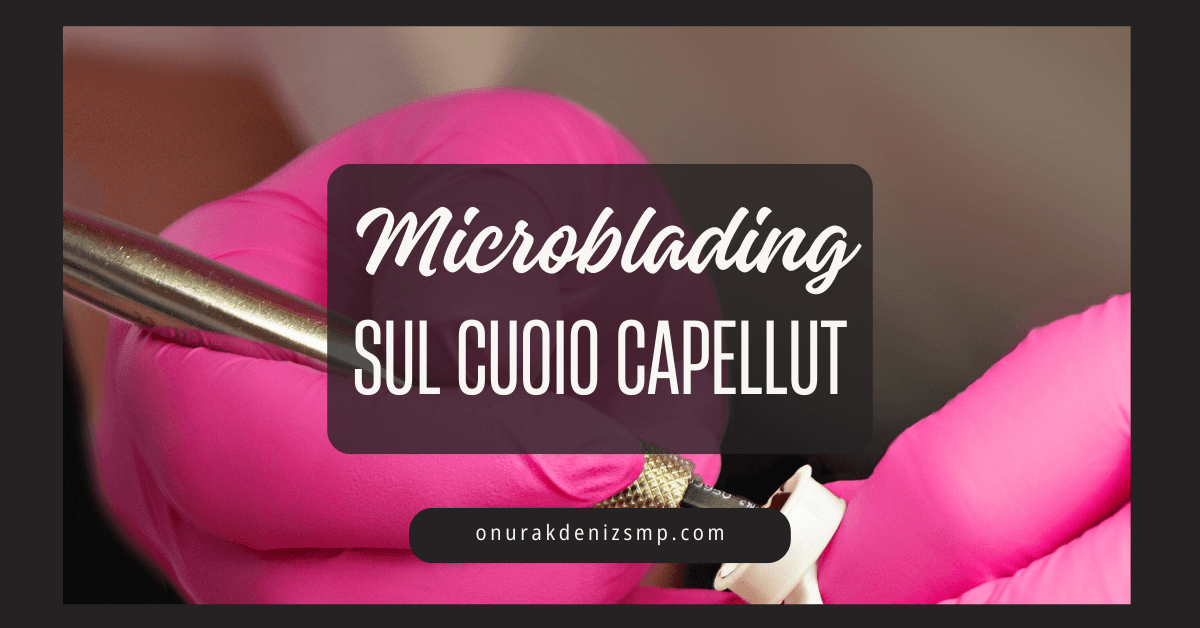 Immagine principale dell'articolo Microblading sul cuoio capelluto di Onur Akdeniz SMP