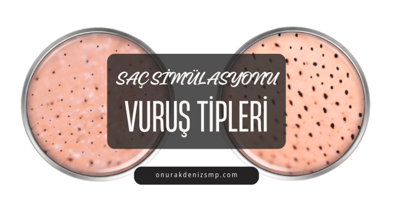Saç Simülasyonu Vuruş Tipleri