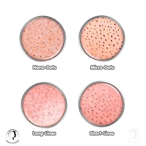 Scalp Micropigmentation Stroke Types Dots and Lines