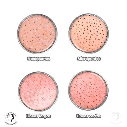 Tipos de trazo en la micropigmentacion capilar 2