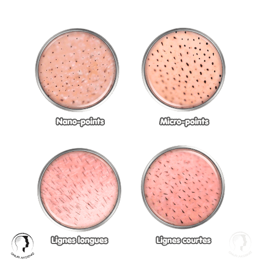 Types de coups daiguille en micropigmentation capillaire 1