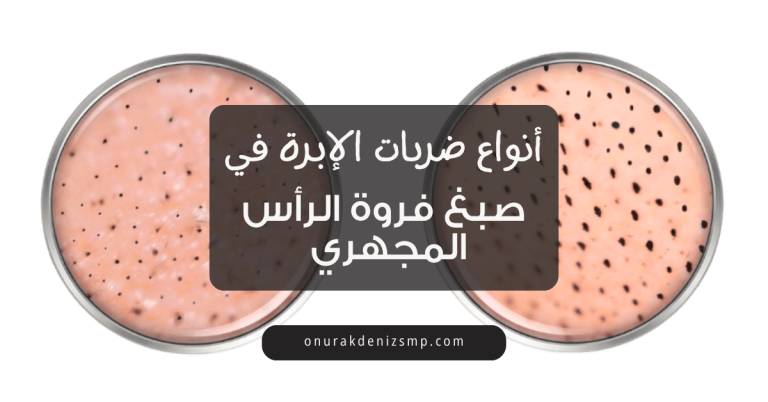 أنواع ضربات صبغ فروة الرأس المجهري