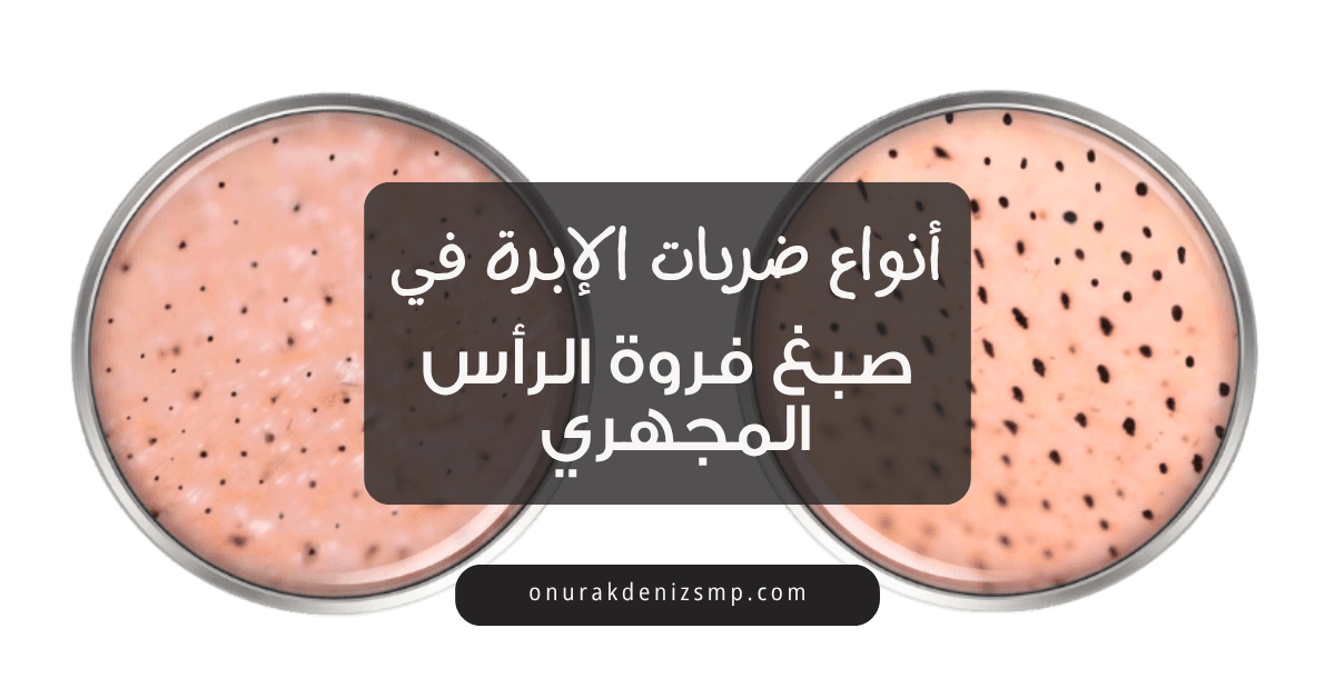 أنواع ضربات صبغ فروة الرأس المجهري