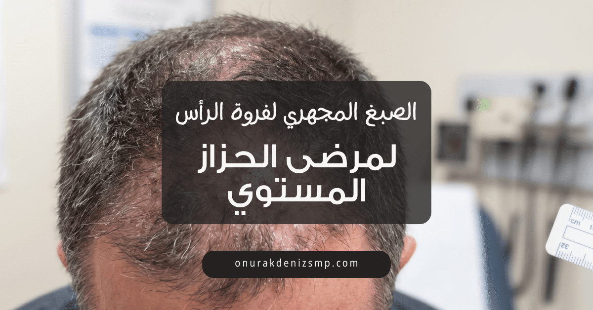 صبغ فروة الرأس المجهري لمرض الحزاز المسطح