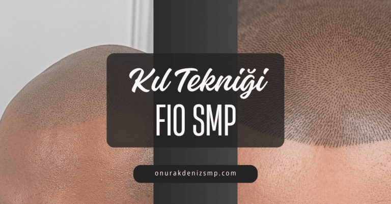 FIO SMP Kıl Tekniği