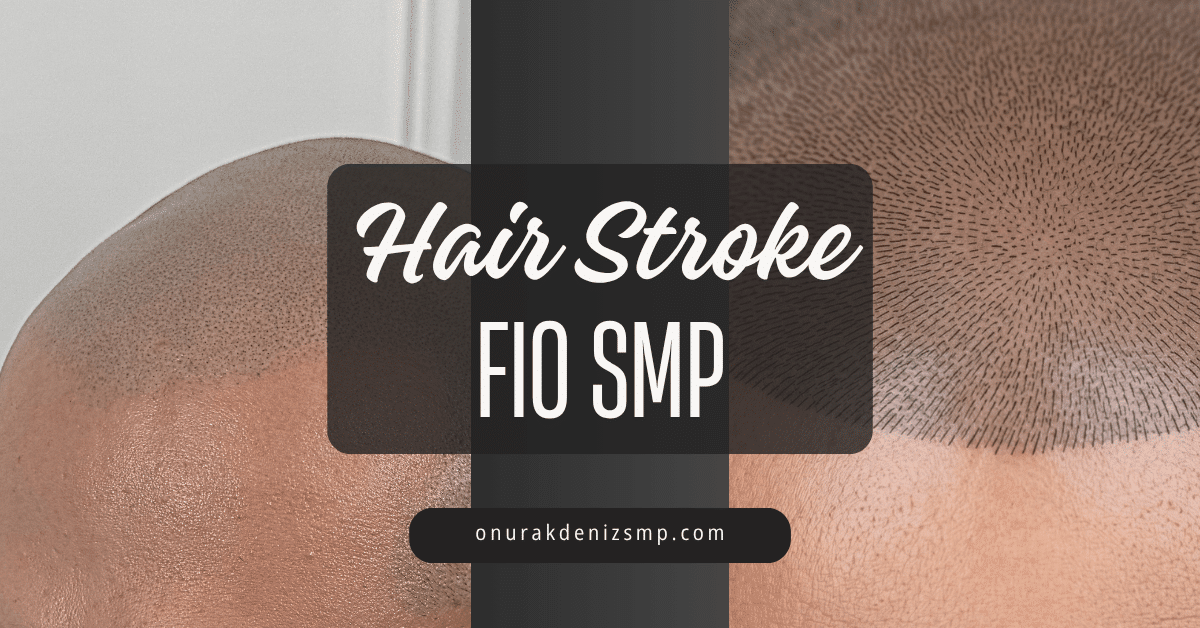 FIO SMP
